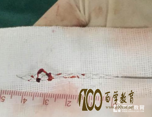 长沙一大学生国庆长假打游戏3天3夜致脑中风!医生提醒每天应保证8小时睡眠!